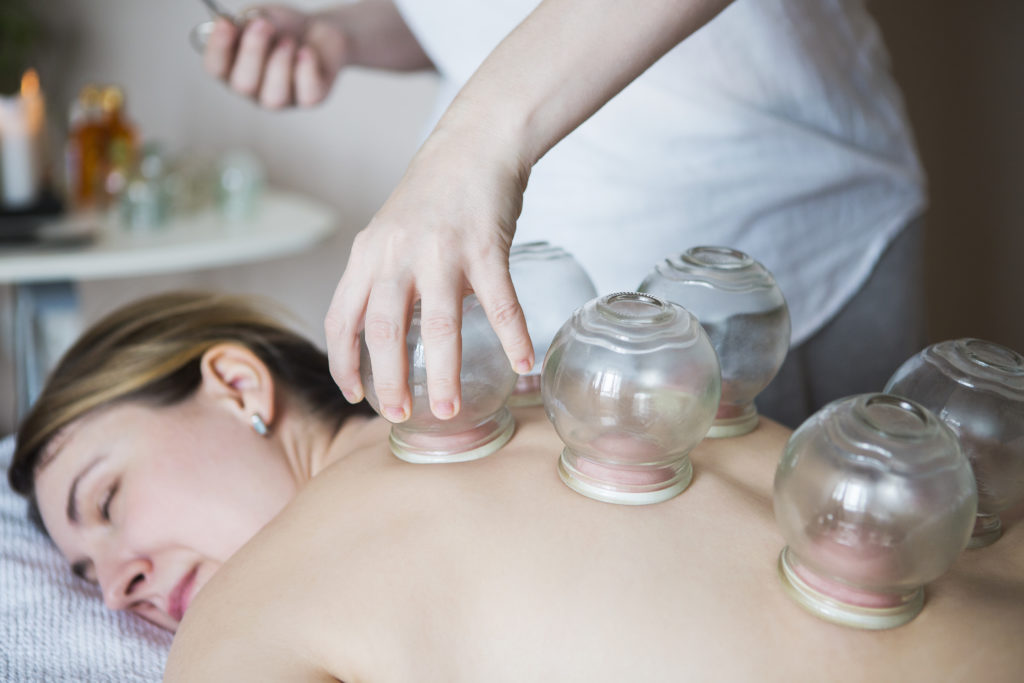 Cupping2L