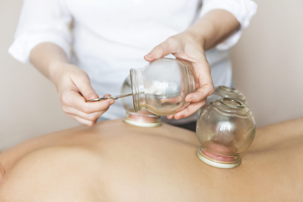 Cupping1L